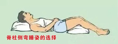 睡姿不正確會對脊柱側(cè)彎產(chǎn)生影響嗎？