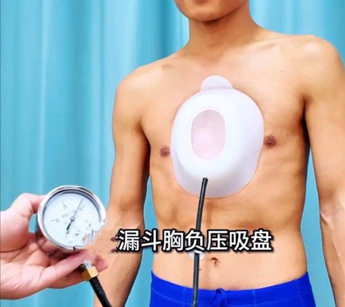 漏斗胸怎么矯正？